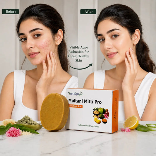 Multani Mitti Pro Acne Care Soap